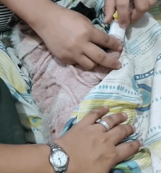 T1011006 Girl rescued mangy dog changed after months #rescue #rescueanimal part2